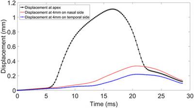 Assessment of age-related change of the ocular support system